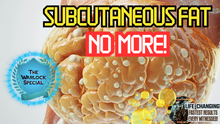 Load image into Gallery viewer, Subcutaneous Fat No More! (Works Very Fast!)