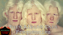 Load image into Gallery viewer, Get Albino White Skin Fast! (Original Classic - Revitalized) (Skin Lightening Formula)